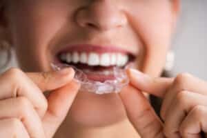 Girl putting on Invisalign braces